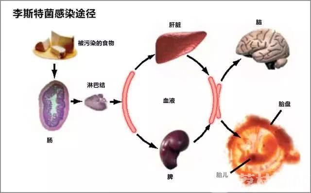 别再什么都往冰箱里塞！当心感染“冰箱杀手”李斯特菌