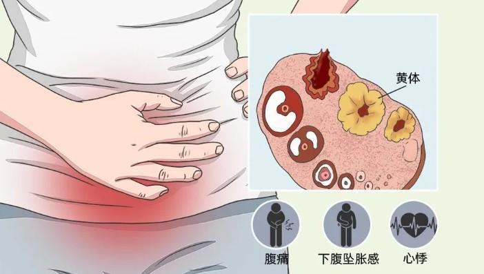 同房后肚子疼图片