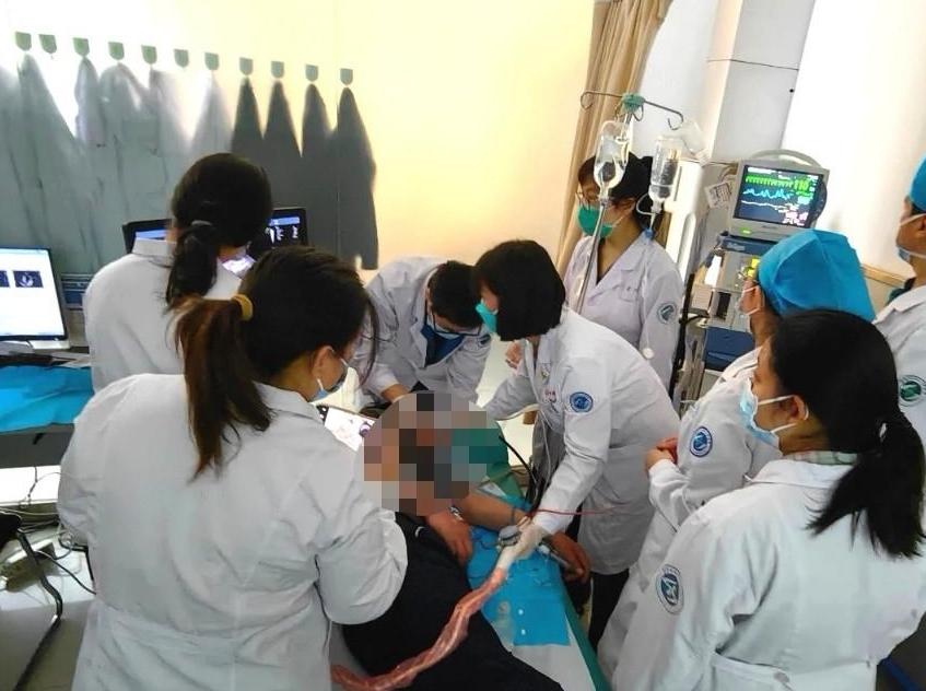 省四院超声医学科经食管超声心动图检查进入无痛时代
