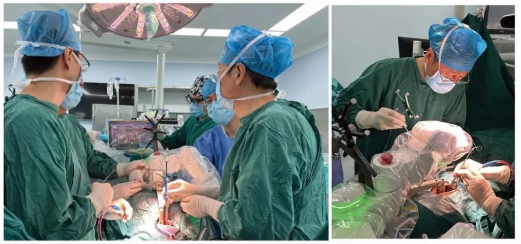 全国首例 ！西安市红会医院成功在MAZOR X机器人辅助下成功实施寰枢椎椎弓根螺钉内固定术