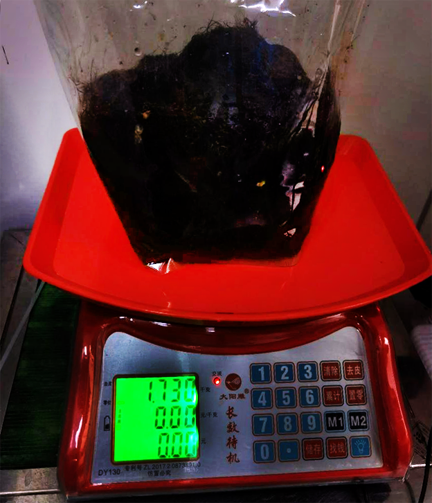九岁女孩胃中取出1.73公斤毛发团  医生提醒异食行为可能是心理疾病