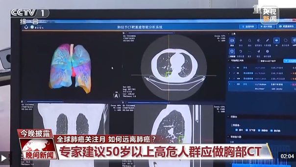 视频丨肺结节≠肺癌 专家建议这些人群应做胸部CT